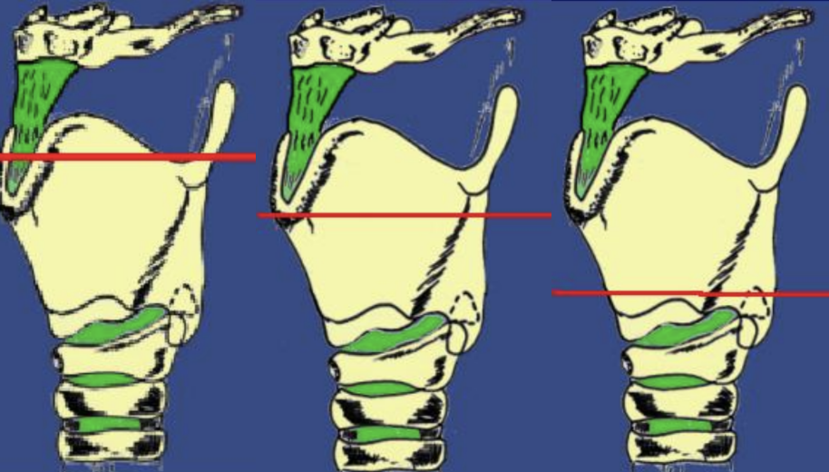 Illustration de différentes coupes d’IR